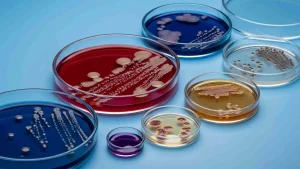 alt="شناسایی سودوموناس آئروژینوزا روی محیط Cetrimide Agar | تولید پیگمان سبز-آبی فلورسنت در تست افتراقی نیکوفارمد | آزمون اکسیداز مثبت"