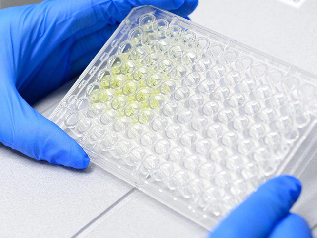 حد مجاز تست اندوتوکسین